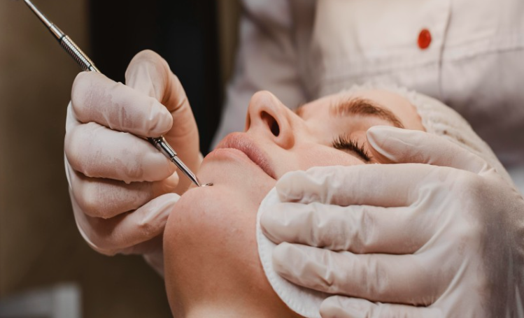 PDRN Skin Treatment